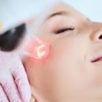 Laser Skin Resurfacing Boynton Beach