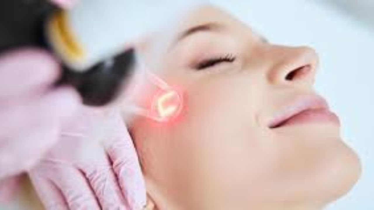 Laser Skin Resurfacing Boynton Beach A Complete Guide to Smoother, Younger Skin